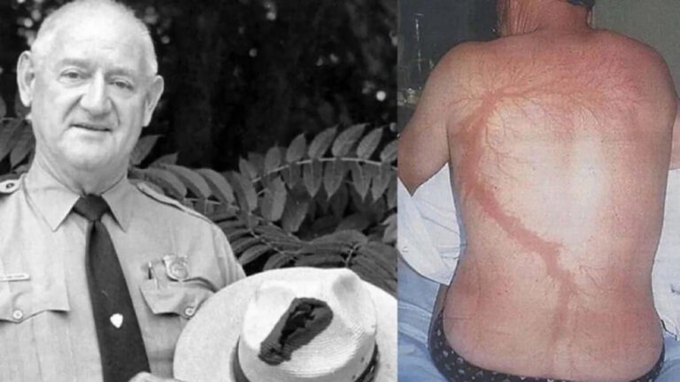 Roy Sullivan: El hombre pararrayos